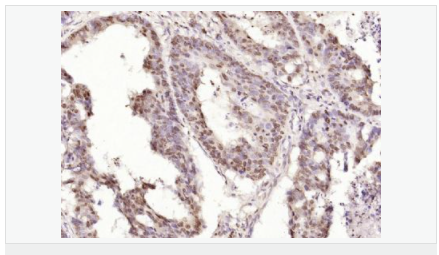 605850492116a.png image.png